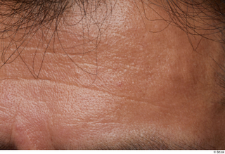 HD Face Skin Luis Gallo face forehead skin pores skin…